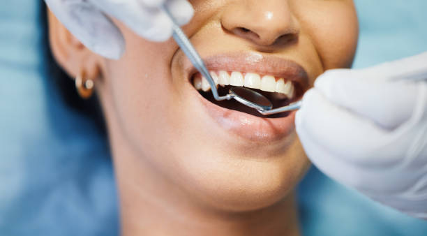 Best Urgent Tooth Repair  in Sunray, TX