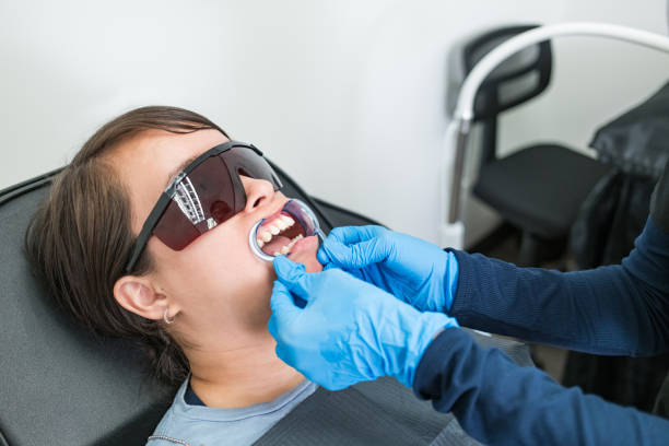 Best Chipped Tooth Repair Near Me  in Sunray, TX
